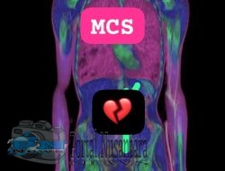 Komplikasi Penyakit Dalam Tubuh MCS Meledak Tidak Bisa Terobati.