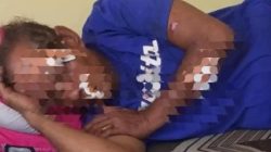 Pria Lansia di Sampang Dianiaya Kerabat Sendiri, Wajah Luka Parah Dihantam Kursi dan Kayu